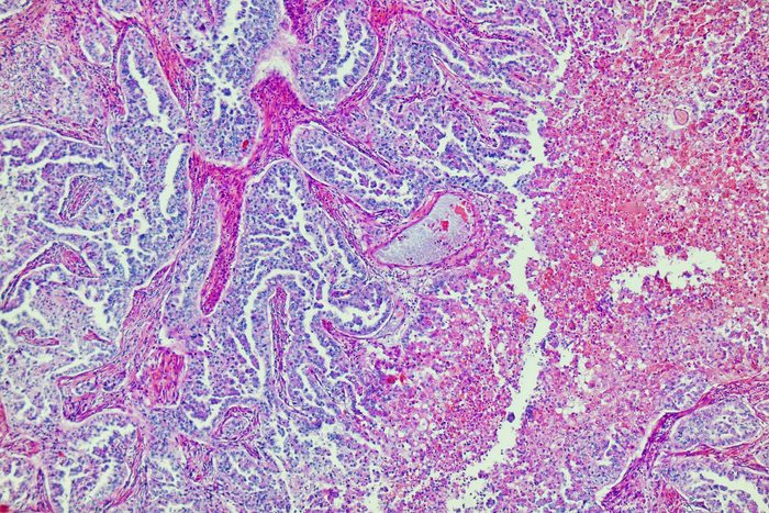 Human liver tissue under microscope view