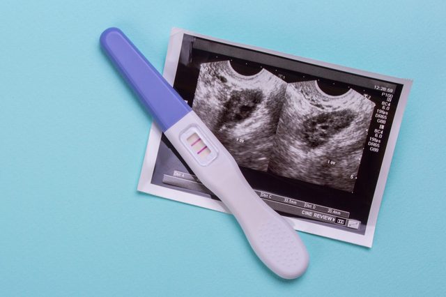 Positive Pregnancy Test On A Light Blue Background Ultrasonic Picture Of A Child In A Live Mother Empty Place For Text Copy Paste