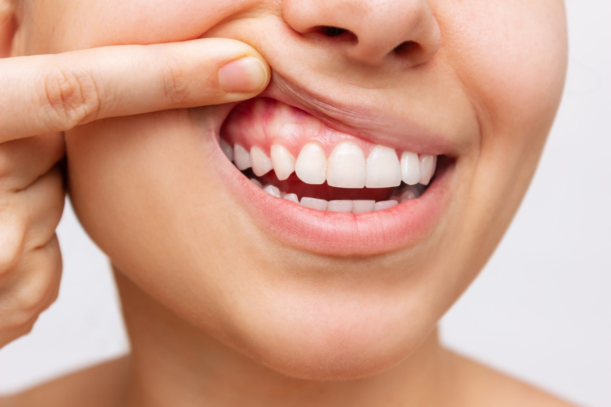 Gum health. Cropped shot of a young woman showing healthy gums