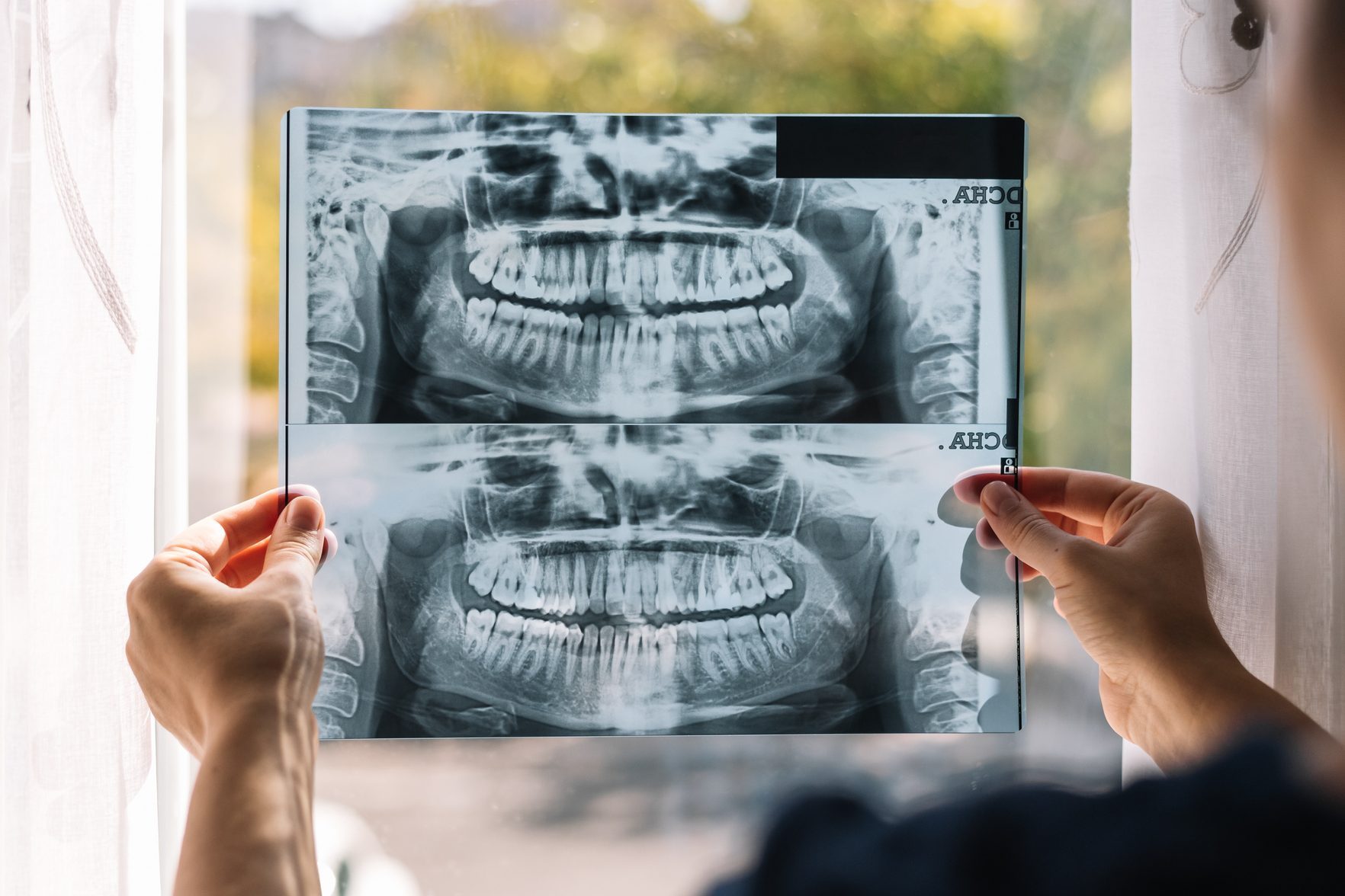 Dentist examining a patient's dental x-ray.