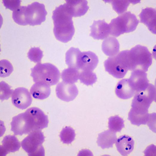 Plasmodium falciparum in ring stage in human red blood cells. Malarial Parasite