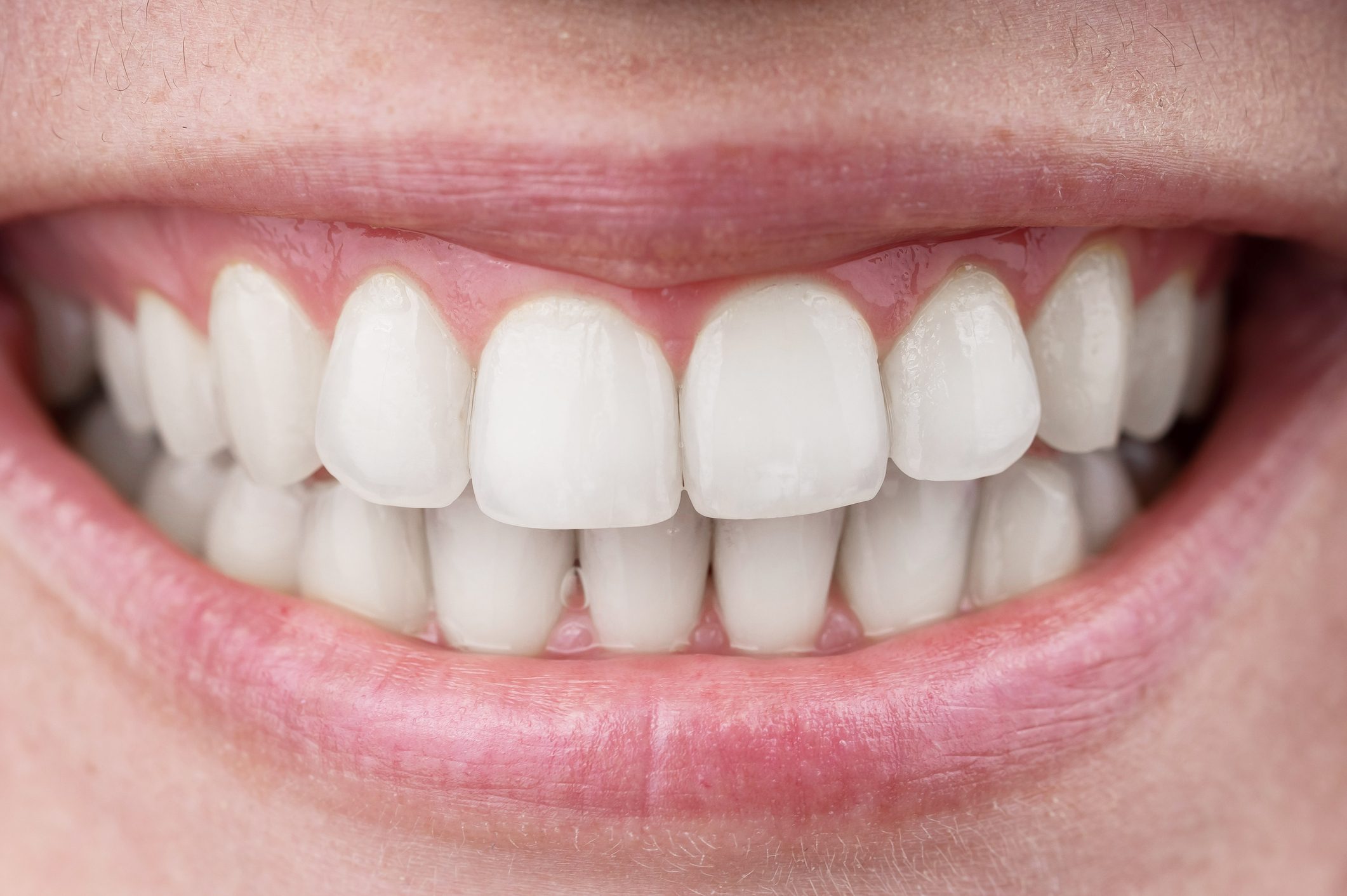 Close-up of a perfect female smile. Macro.