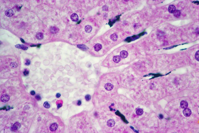 signs liver healing from alcohol