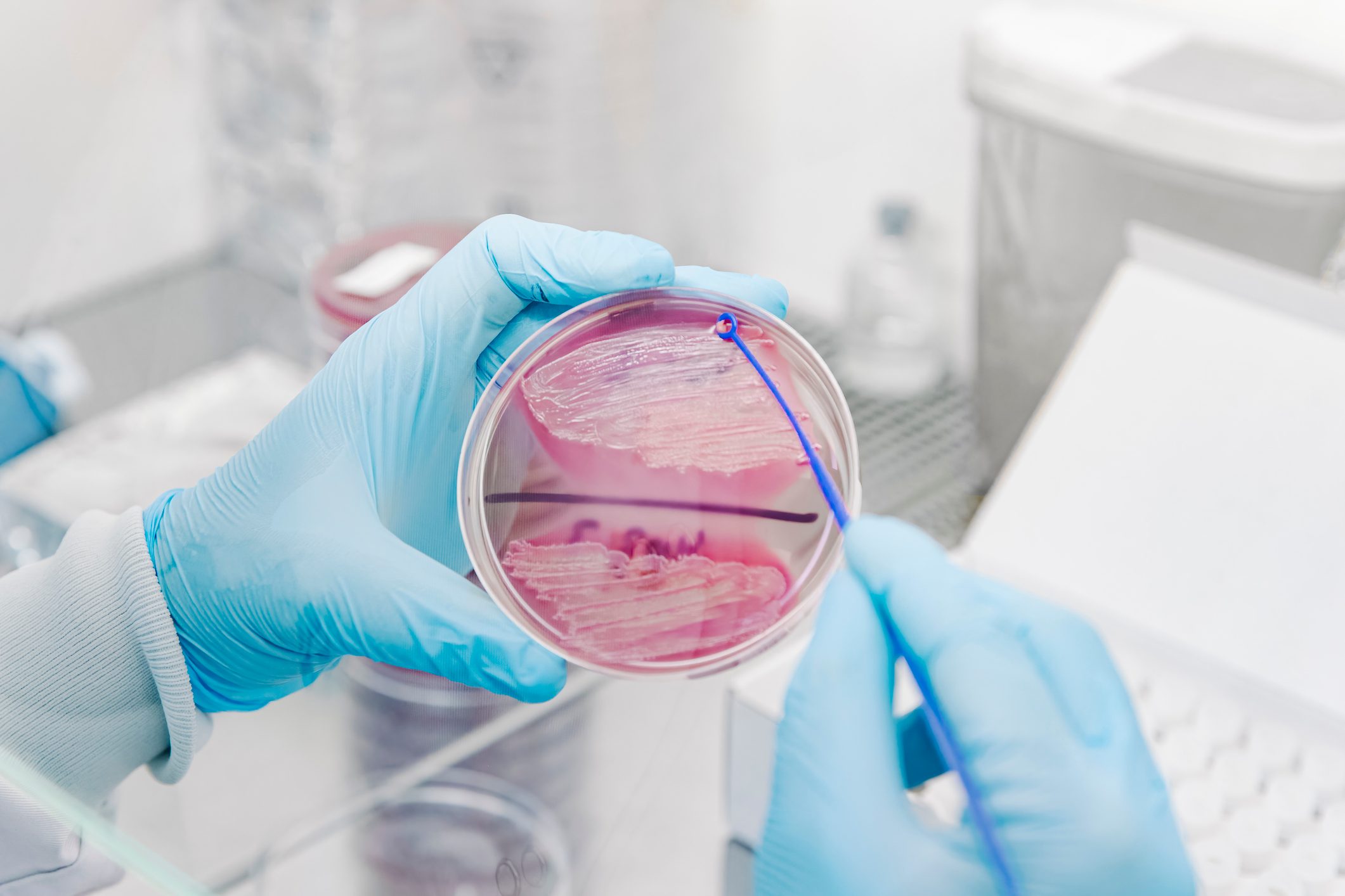 Worker scientist taking some colonies from a petri dish with a loop