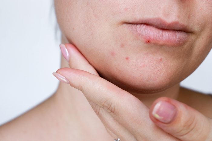 11 Surprising Diseases That Dermatologists Find First