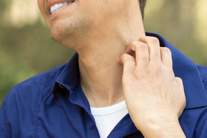 man suffering itching scratching neck