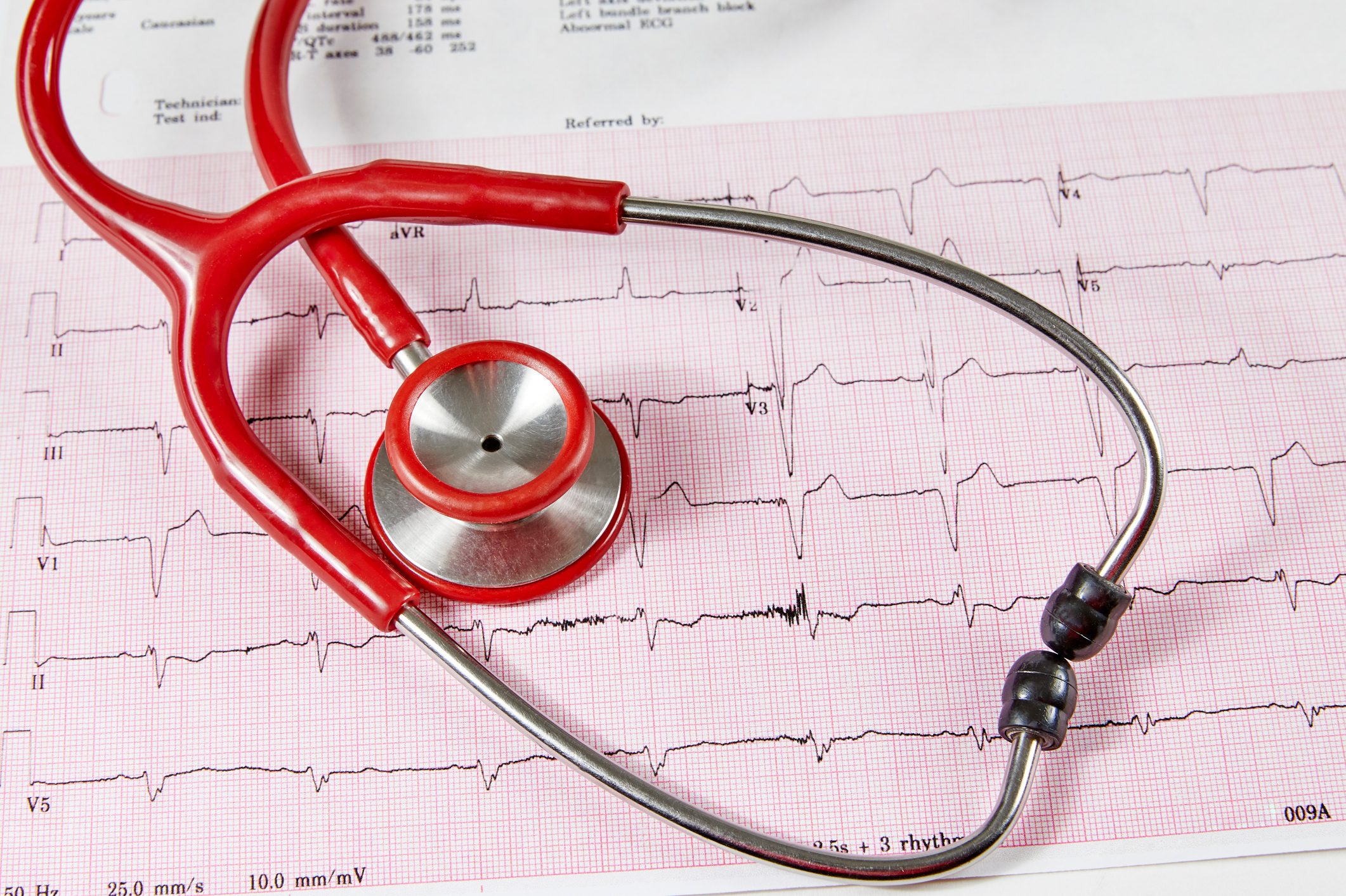 Abnormal Echocardiograph Report with a Red Stethoscope