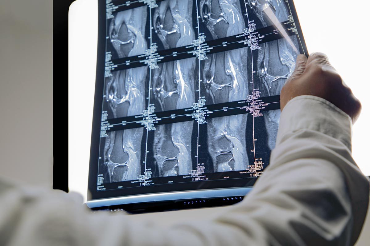 8 Causes For Pain Behind The Knee