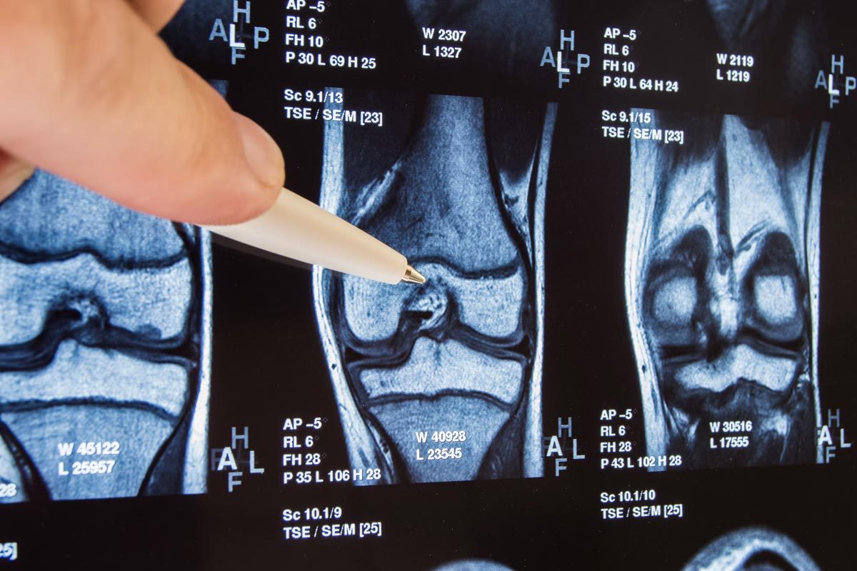 8 Causes For Pain Behind The Knee