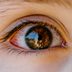 What Is Commonly Misdiagnosed as Pink Eye? An Expert Eye Doctor Shares the List